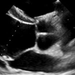 تصویر پروفایل  ASMA